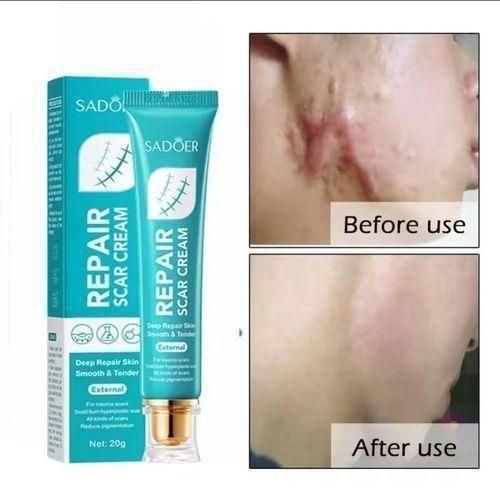 SADOER Repair Scar Cream