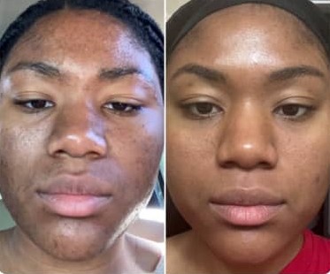 Customer result