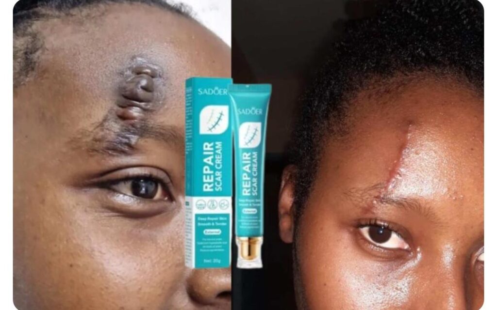 Customer result